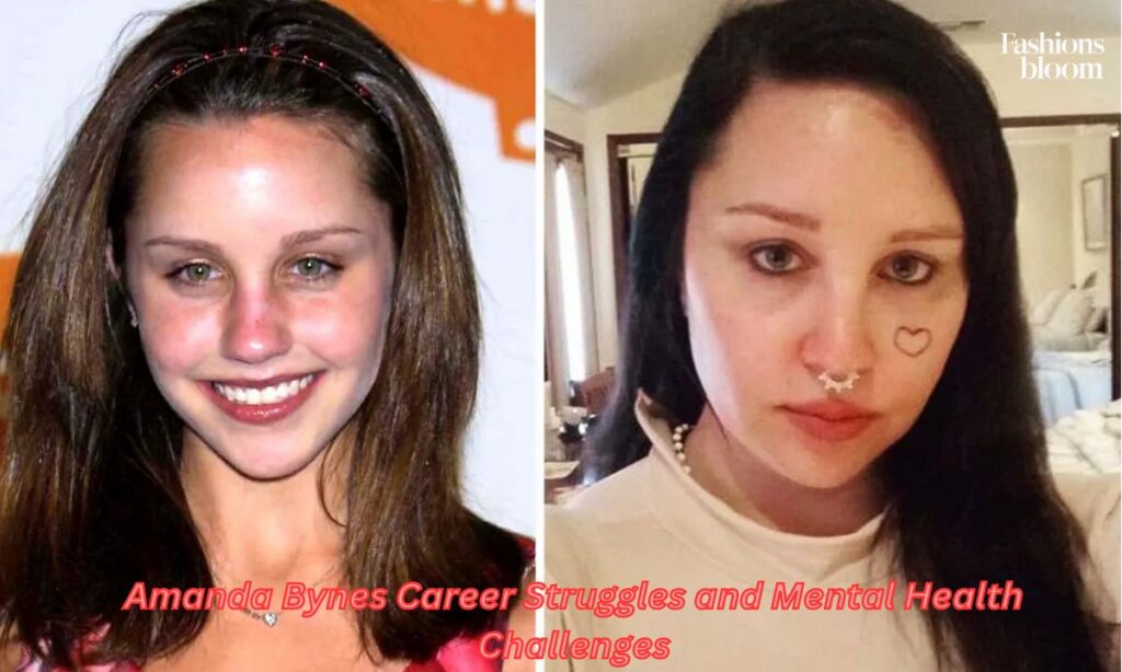 Amanda Bynes Career Struggles and Mental Health Challenges